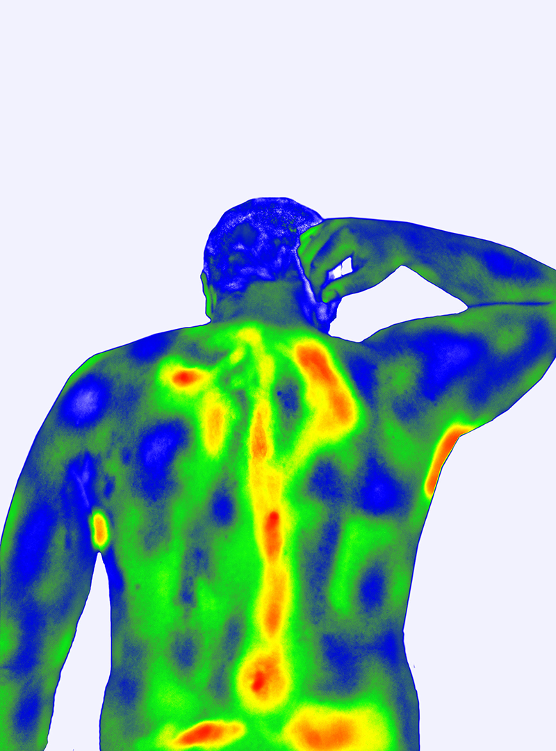 Thermal image of back pain in a patient